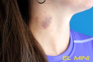 chupón de El mini 2015