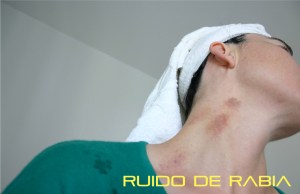 Ruido de Rabia 02